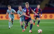 Dani Olmo tiếp tục vắng mặt trận gặp Leganes
