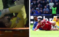 Mamardashvili dính chấn thương nặng ở trận derby Merseyside