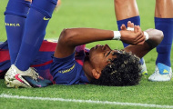 Barcelona học cách sống sót thiếu Lamine Yamal