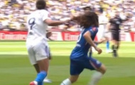 Calvert-Lewin thoát thẻ đỏ dù giật tóc Cucurella