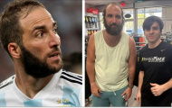 Hình ảnh mới nhất của Higuain khiến fan bóng đá sững sờ
