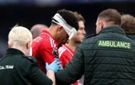 Gibbs-White có thể đấu Aston Villa bất chấp chấn thương vùng đầu