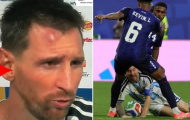 Lionel Messi và vết sưng trên trán sau trận thắng Cape Verde