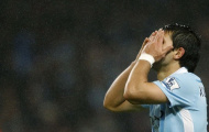 Man City: Mất 'sao' mới biết mặt nhau!