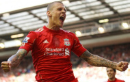 Martin Skrtel: Liverpool chẳng kém gì các đội bóng trong top 4