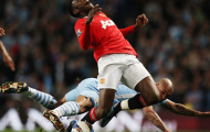 Welbeck gặp chấn thương nặng sau trận MU thua Man City
