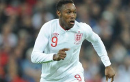 Welbeck nóng lòng thể hiện tại EURO