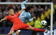 Man City sẵn sàng thu nạp Skrtel