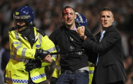 Phòng chống nạn phân biệt chủng tộc tại EURO 2012: “Để dân biết, dân làm”