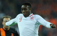 Danny Welbeck: Hàng công tuyển Anh sẽ chơi tốt hơn trong trận gặp Thụy Điển