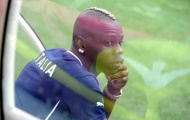 'Ngựa chứng' Balotelli dính chấn thương