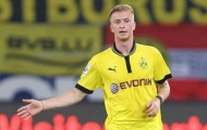 Cựu Giám đốc Chelsea thấy Reus có tiềm năng thành siêu sao