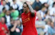 Agger bị treo giò trận gặp Man City