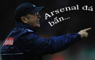 Pulis: Arsenal “đá bẩn” không kém Stoke City