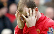 Wayne Rooney và nỗi ám ảnh chấn thương