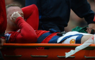 Chấn thương của Wayne Rooney nặng hơn dự kiến: Hẹn gặp lại tháng Mười một