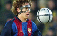 Chiến binh Puyol sẽ đeo mặt nạ để quyết đấu với Real