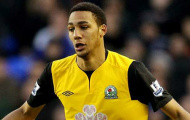 Stoke City 'cuỗm' được N'Zonzi từ tay Blackburn Rovers