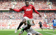 Sau Ashley Young, tới lượt Welbeck bị gọi là 'kịch sỹ'