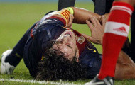 CẬP NHẬT: Puyol nhiều khả năng sẽ phải nghỉ 2 tháng