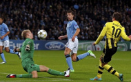 Joe Hart ví mình như 'đứa trẻ trông công viên' trước Dortmund