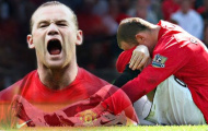 Phát hiện: Rooney chơi hay hơn nhờ... chấn thương