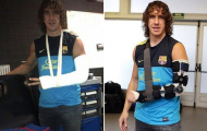Bình phục thần tốc, Puyol có thể trở lại sớm hơn dự kiến