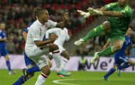 Theo Walcott bị nghi ngờ gẫy xương sườn