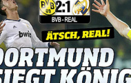 Báo giới Đức “xát muối” vào nỗi đau của Real Madrid