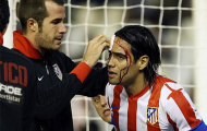 Máu chảy ròng ròng trên khuôn mặt của 'mãnh hổ' Falcao
