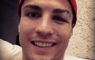 Ronaldo thông báo tình hình chấn thương