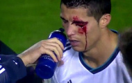 David Navarro nhắn tin xin lỗi Cristiano Ronaldo