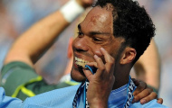 Mancini đem tin vui đến với Lescott