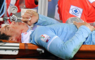 Hernanes nghỉ đá 20 ngày?