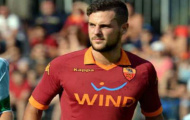Destro mong kịp bình phục trước trận Derby