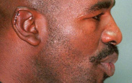 Mike Tyson & cú cắn tai lịch sử