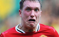 Những trạng thái cảm xúc trên gương mặt của 'hội chứng Phil Jones'