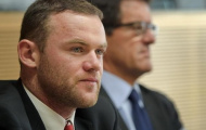 Tóc của Rooney: Vô phương cứu chữa
