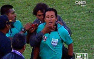 Cay cú, HLV Peru “hổ báo” bóp cổ trọng tài biên