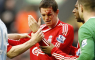 Agger làm đội phó Liverpool, Barca đứng ngoài nhìn