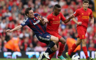 18h45 ngày 17/08, Liverpool vs Stoke City: Vạn sự khởi đầu nan