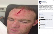 Ấm ức tin thất thiệt, Rooney lần đầu lên tiếng về chấn thương