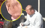 Mổ xẻ chấn thương kinh dị của Rooney: Lỗi tại David Moyes!