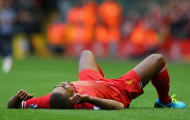 Johnson sớm trở lại, Rodgers cầu nguyện cho Sturridge