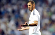 Benzema rất giỏi... “'phá bóng'