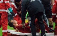 Badstuber phải phục hồi chức năng sau khi phẫu thuật