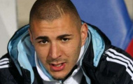 Ancelotti nên cắt suất Benzema