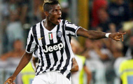 Man City biến Pogba thành “Tevez mới” với 40 triệu bảng