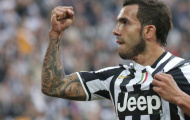 Tại Juventus, không có những cái tôi