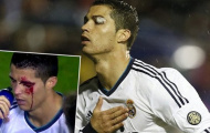 Cú sốc đột quỵ, suýt bỏ mạng trên sân của Ronaldo